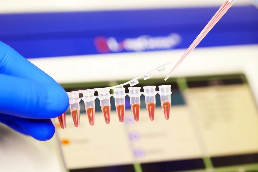 PCR/qPCR ઉપભોજ્ય વસ્તુઓ કેવી રીતે પસંદ કરવી?